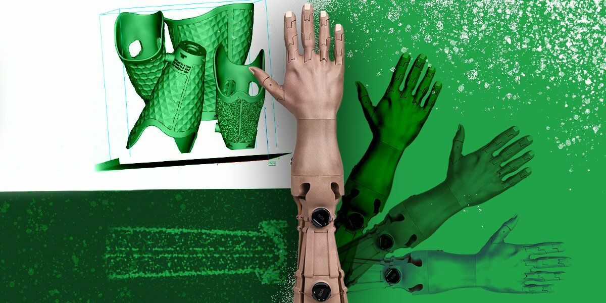 3D nyomtatás és protézisek: költségek és biztosítási kihívások 3d nyomtatas protezisek gyartasa koltsegek biztositas innovacio