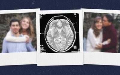 Új kutatás az Alzheimer-kór társas memória-vesztésének okairól és lehetséges terápiás célpontokról