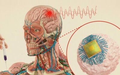 Circulatronics: Forradalmi műtét nélküli agyi implantátum az MIT-től