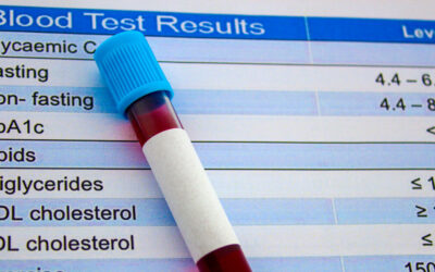 Új génszerkesztő terápia csökkentheti az életveszélyesen magas koleszterinszintet