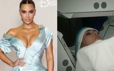 Kim Kardashian agyi aneurizmája: stressz és egészség a reflektorfényben