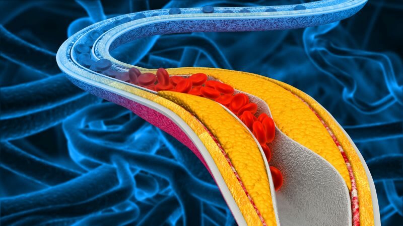 oralis pcsk9 gatlok koleszterin csokkentes sziv es errendszeri betegsegek