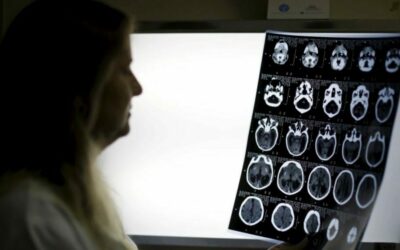 Gyermekek orvosi képalkotása és a rák kockázata: Mit mutat a legújabb kutatás?