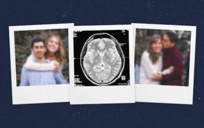 Új remény az Alzheimer-kór kezelésében: a perineuronális hálók védelme