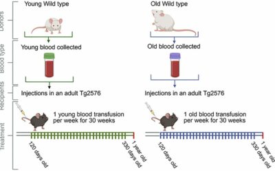 Az öreg és fiatal vér hatása az Alzheimer-kórra: új kutatási eredmények az agyi amiloidózisról