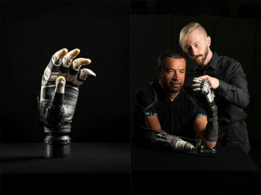 Robotikus protézis AI-alapú ujjérzékelőkkel az University of Utah-tól robotikus protezis ujjak erzekelokkel mesterséges intelligencia technologia